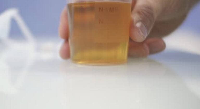 Proses Pembentukan Urine